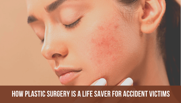 How Plastic Surgery Is A Life Saver For Accident Victims