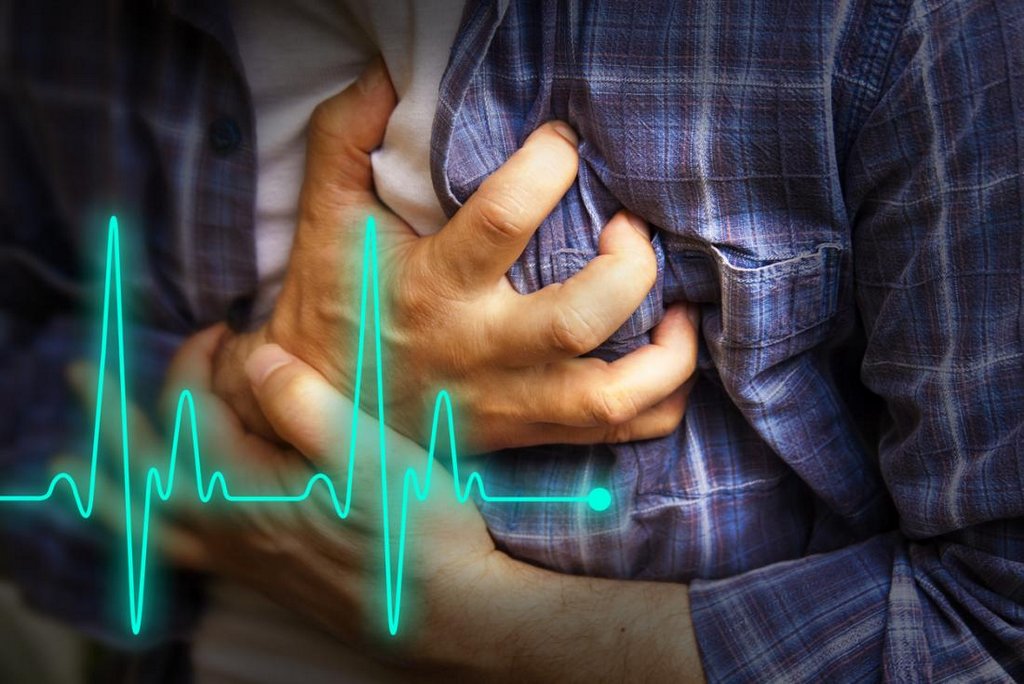 Cardiac Arrest Causes, Risks and Treatment