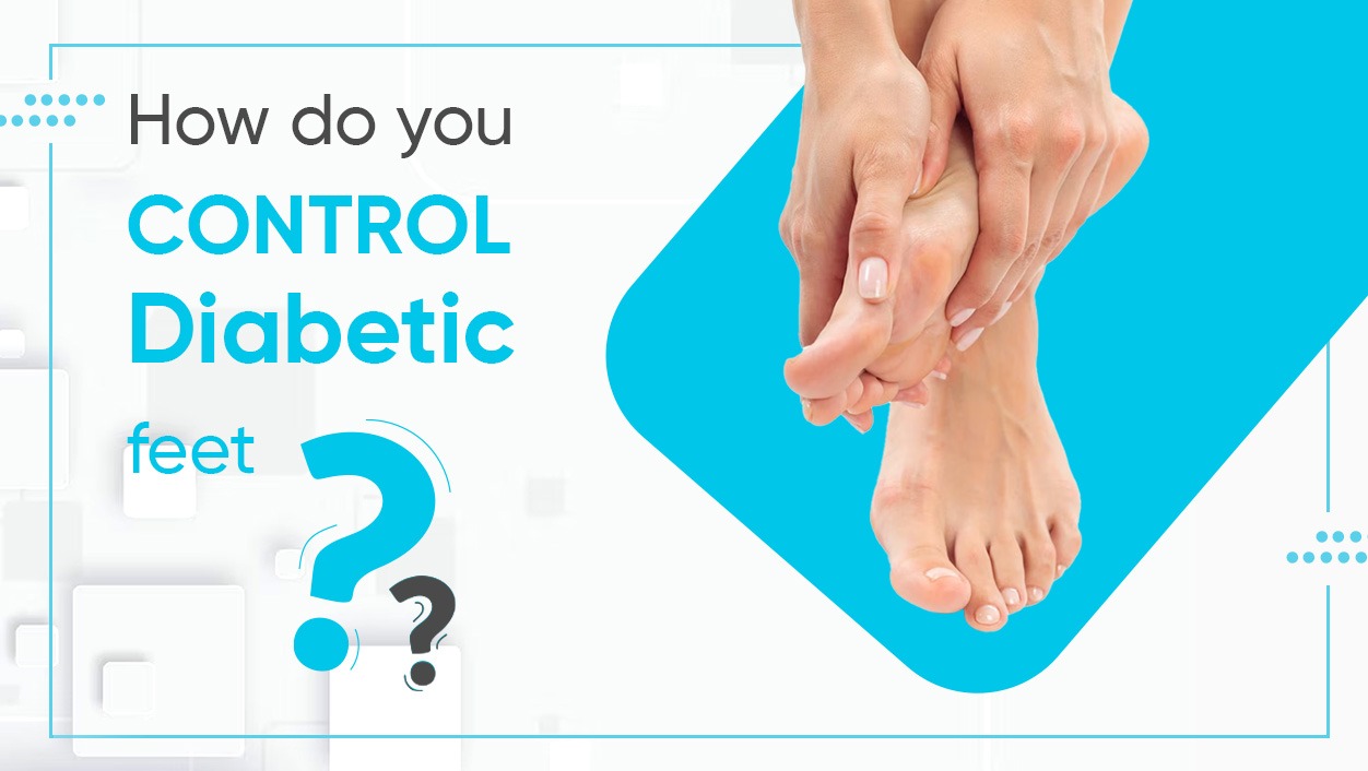 How do you control diabetic feet?